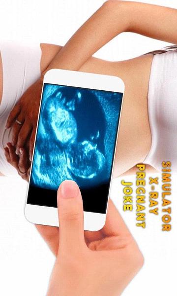 �ֻ�ɨ������������