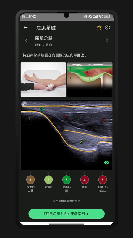 超声智学 超声智学